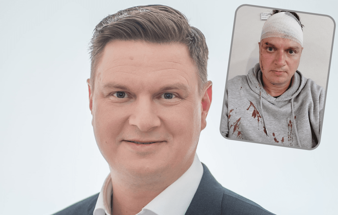 Pullolla pahoinpidelty jukka hallikainen kertoo voinnistaan  lähtee pää siteessä meritangoille | tanssiin Fi