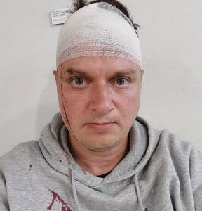 Jukka Hallikainen veri