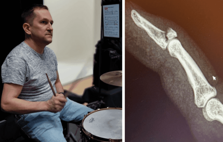 Vily Kattilakoski sormi