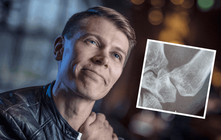 Vili Mustalampi käsi